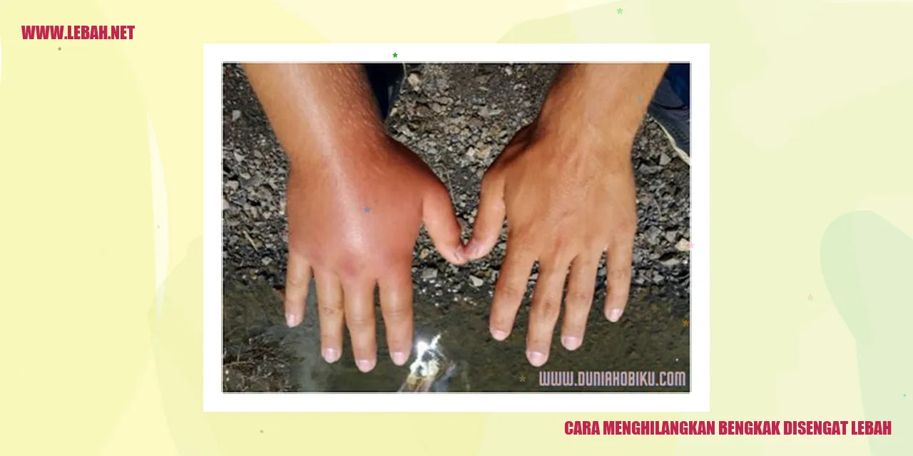 cara menghilangkan bengkak disengat lebah