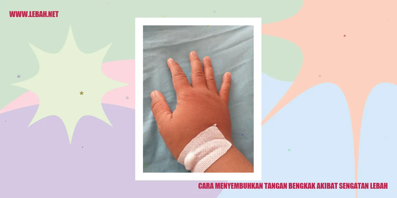cara menyembuhkan tangan bengkak akibat sengatan lebah