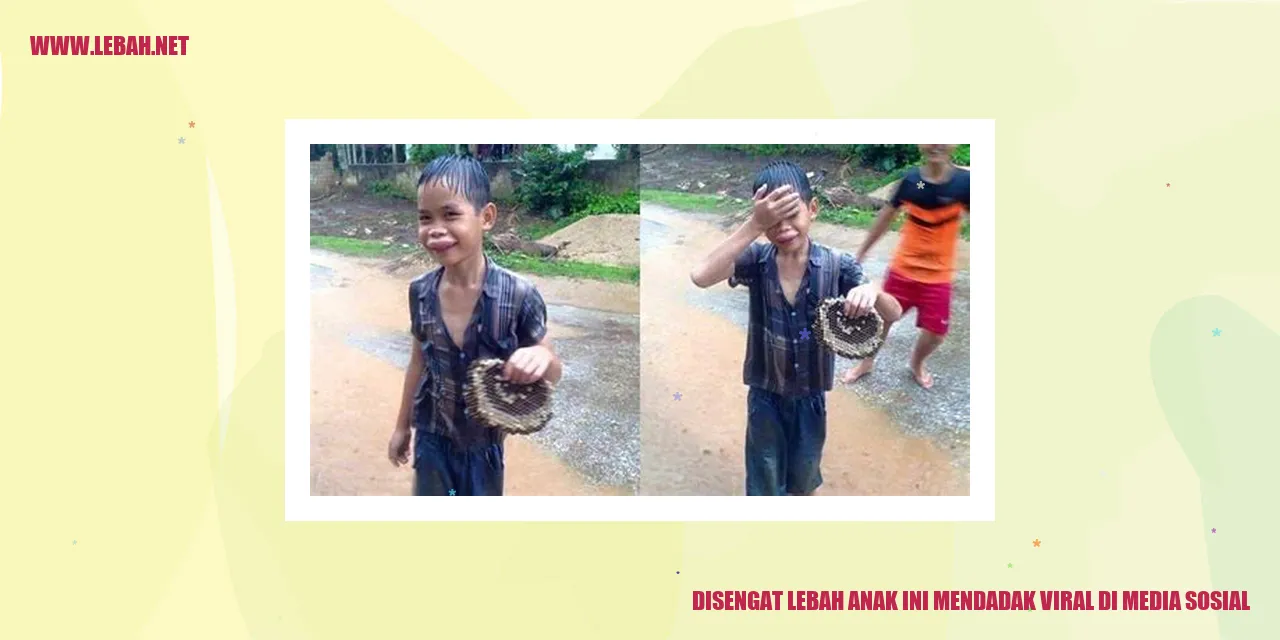 disengat lebah anak ini mendadak viral di media sosial