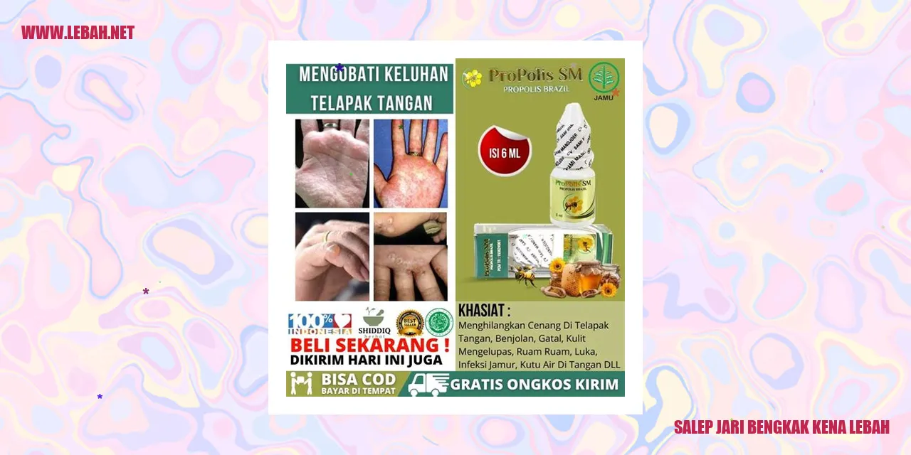 Salep Jari Bengkak Kena Lebah